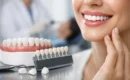 Ce sunt fațetele dentare și când merită